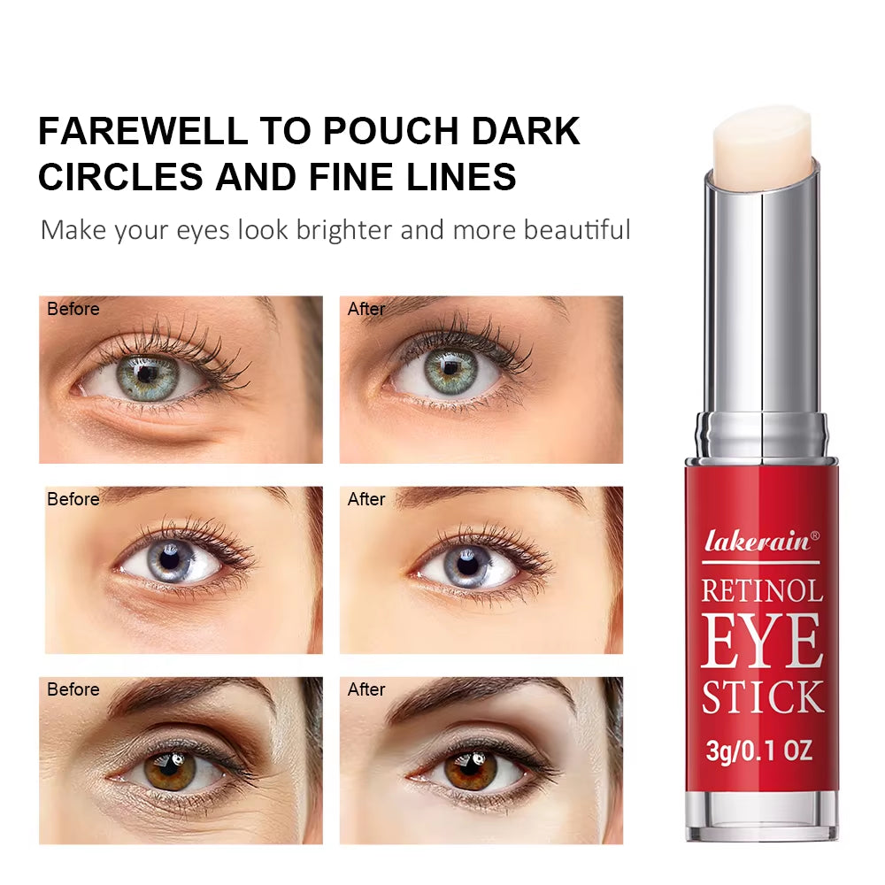 Revitalizing Retinol Eye Cream - Brighten Dark Circles & Firm Skin with Instant Repair Serum Stick for Women