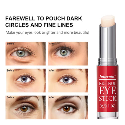 Revitalizing Retinol Eye Cream - Brighten Dark Circles & Firm Skin with Instant Repair Serum Stick for Women